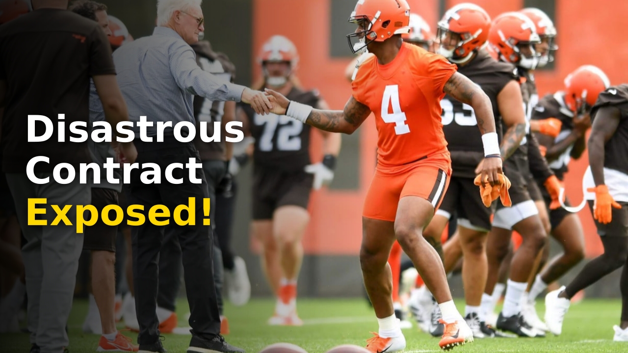 Watson contract